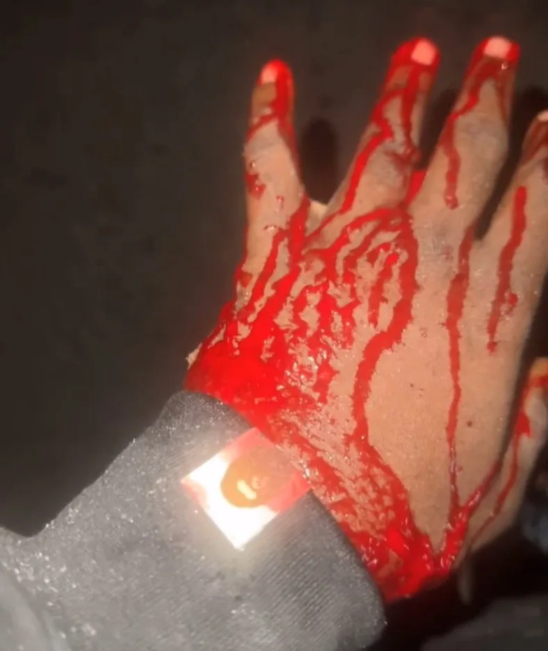 Leverkusen and Nigeria star Victor Boniface survives serious car crash