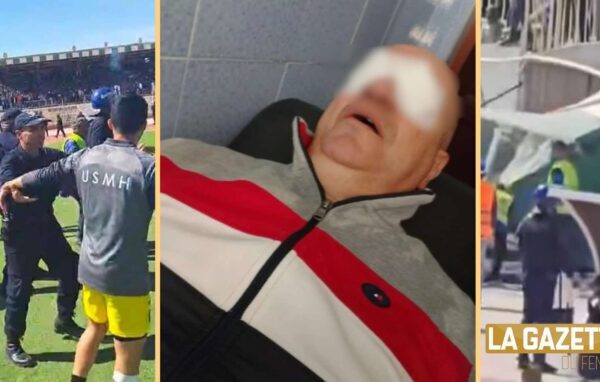 USMH manager Mustapha Maza injured in shocking acid attack