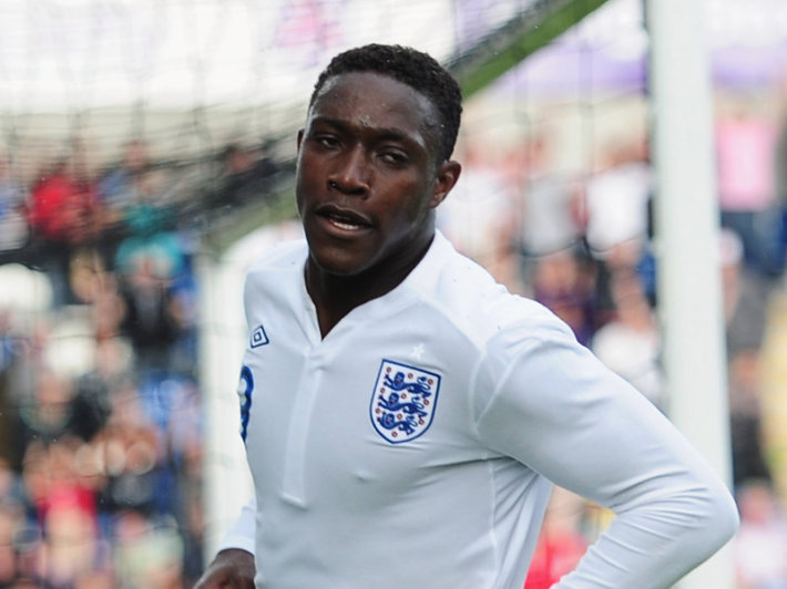  Welbeck 710x532   2014 World Cup Danny Welbeck Very Doubtful for Italy Match   AfricaSoccercom