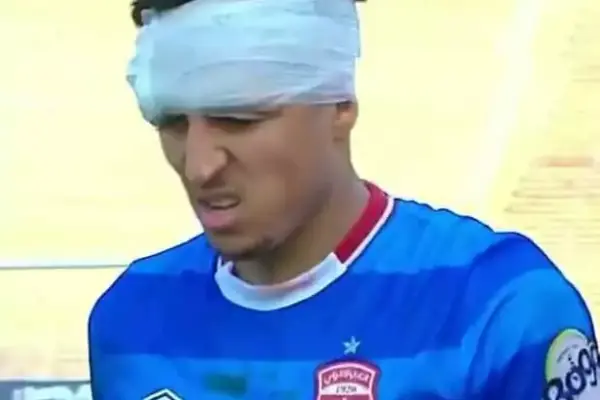 Tunisia: Club Africain relieved as Fahd Mesmari cleared of serious injury after head knock