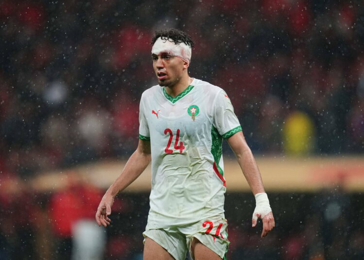  neil el aynaoui est revenu sur le terrain malgre une arcade sourcilliere ouverte lors de la finale de la can dimanche photo sipa 1768846106 750x536   Neil El Aynaoui praises Moroccan fans despite AFCON 2025 disappointment   AfricaSoccercom